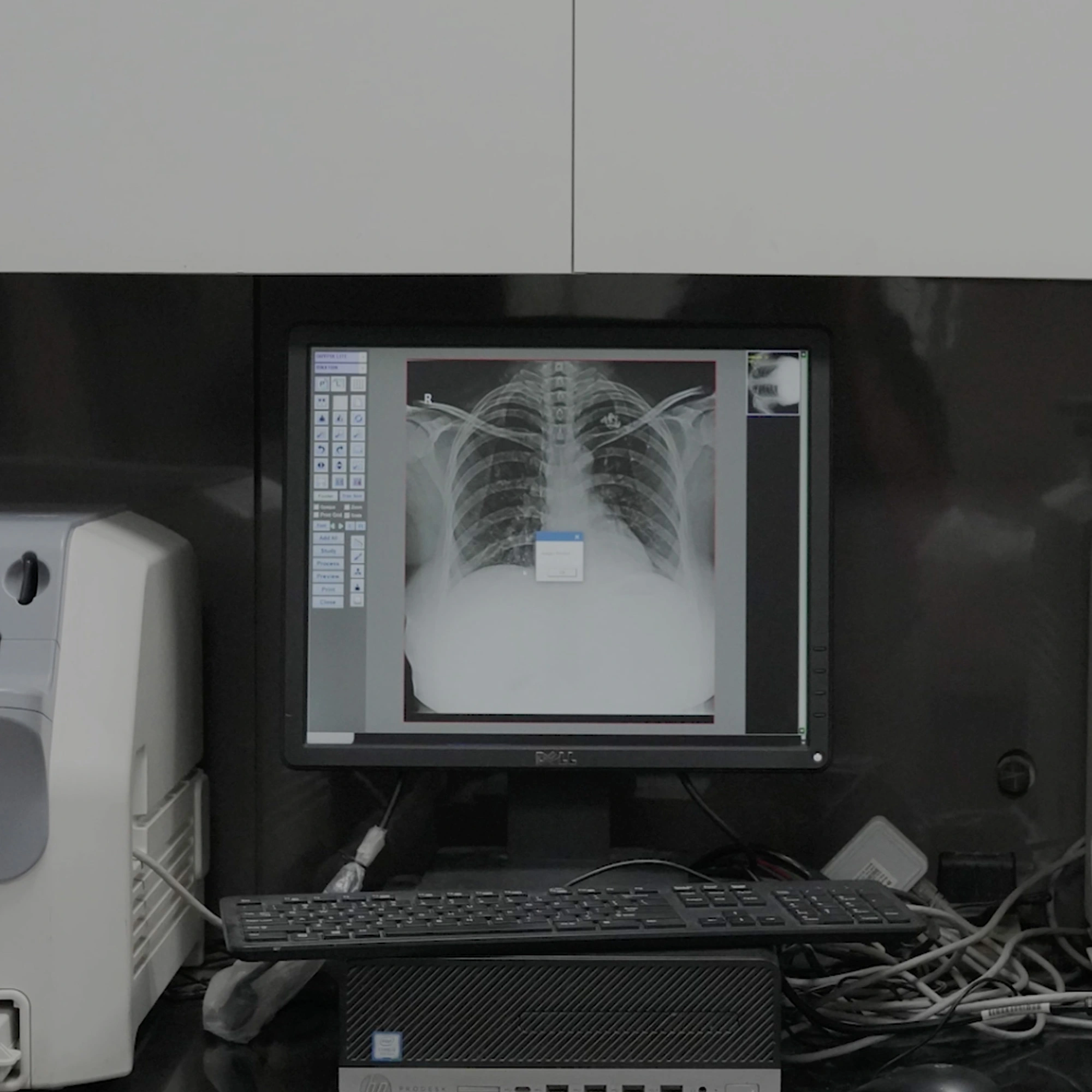best digital x-ray and hsg in faridabad